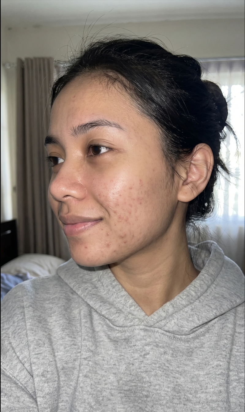 After  weeks — Zoe