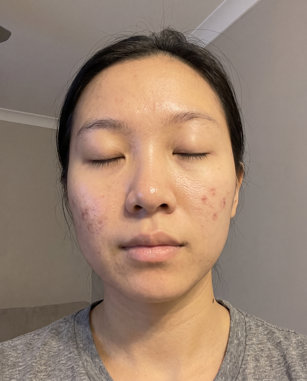 After — Yuna